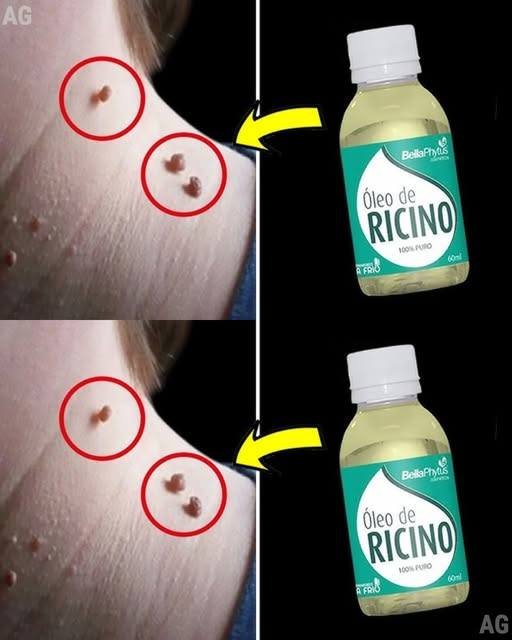 O que quase ninguém sabe sobre o óleo de rícino