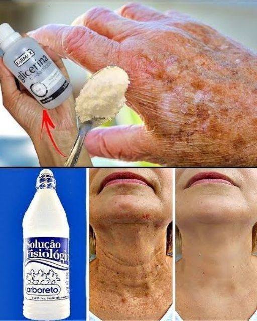 Receita Caseira Hidratante para Cuidar da Pele